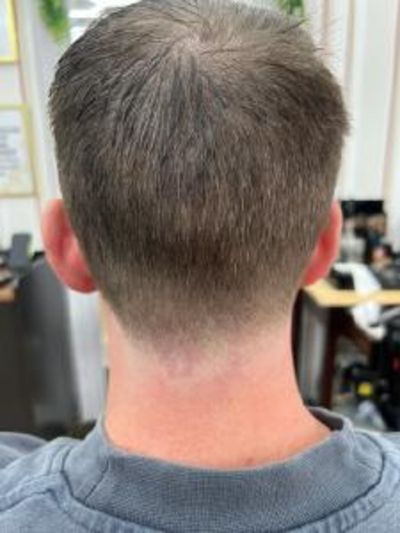 Back of a person's head with a faded haircut, visible scalp, and red neck.