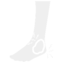 A silhouette of a person 's foot with a broken ankle.