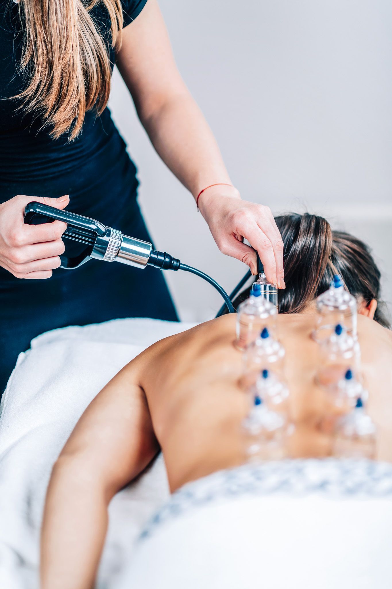 A woman is getting a cupping treatment on her back.
