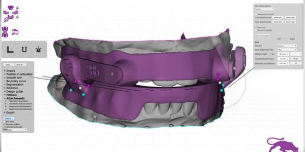 Close up animated diagram of purple oral appliance used for sleep apnea therapy.