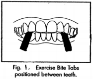 Front-view animation of bite tab instructions.