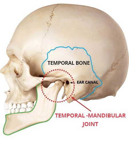 Illustrated diagram of human skull focusing on chronic jaw pain caused by TMJ.