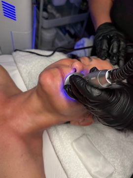nala-med-spa-hydrofacial-skin-rejuvenation-image