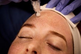 nala-med-spa-prp-therapy-image