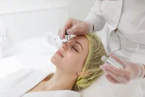 nala-med-spa-microneedling-and-collagen-induction-image
