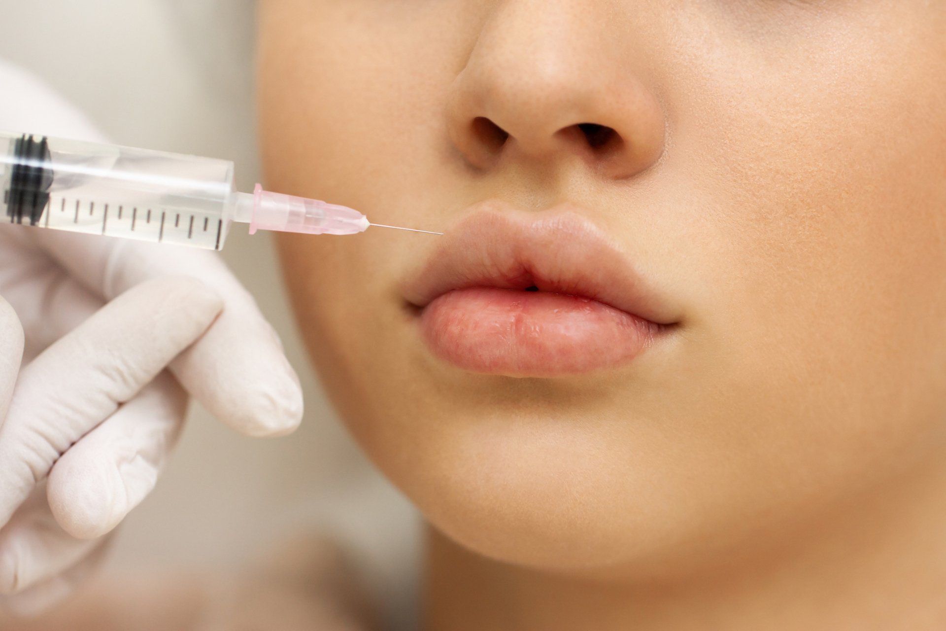 Fillers — Brighton, MI — Dermatology Specialists of Brighton