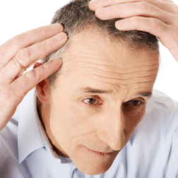 Hair Loss — Brighton, MI — Dermatology Specialists of Brighton
