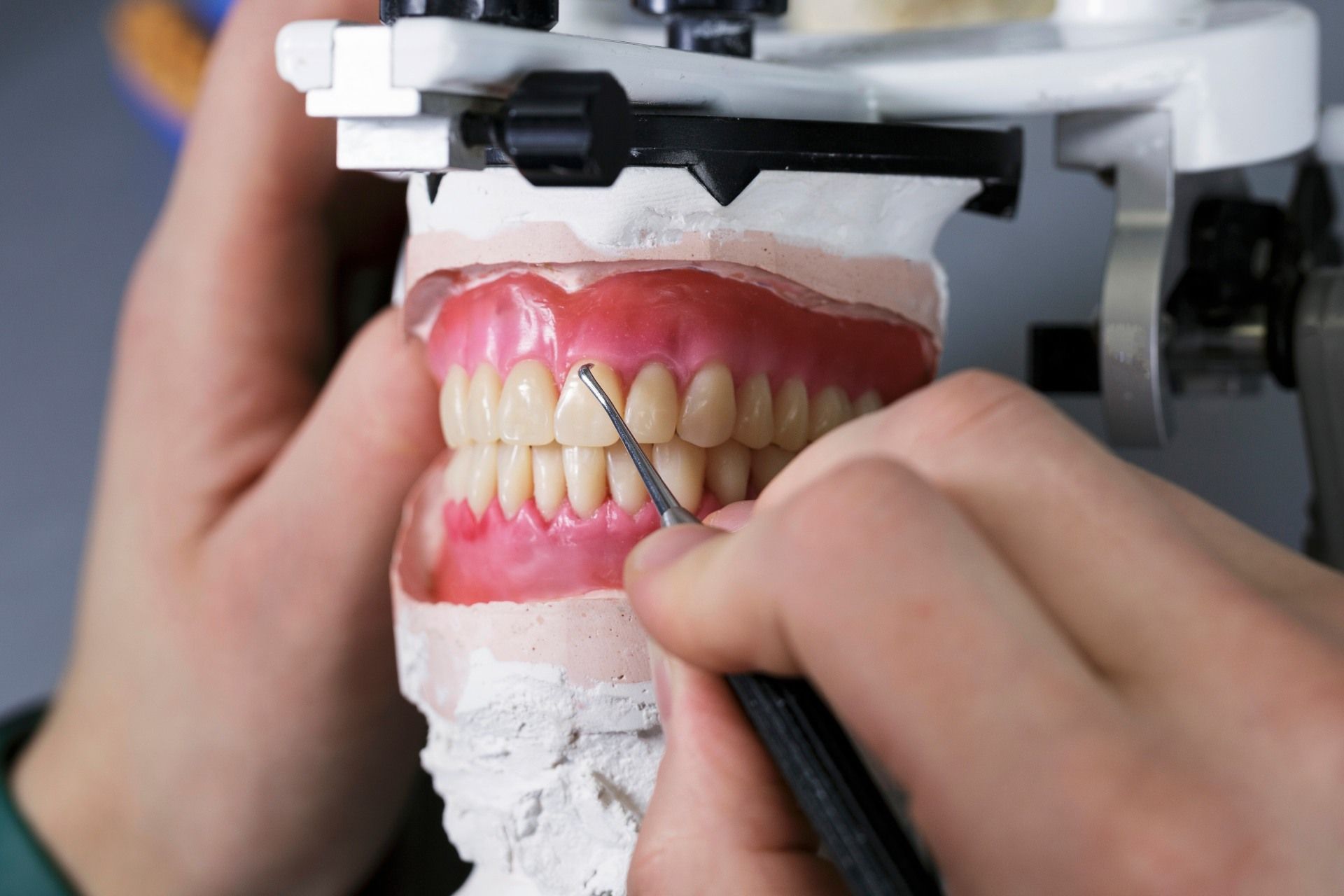 A dentist is working on a model of a person 's teeth.