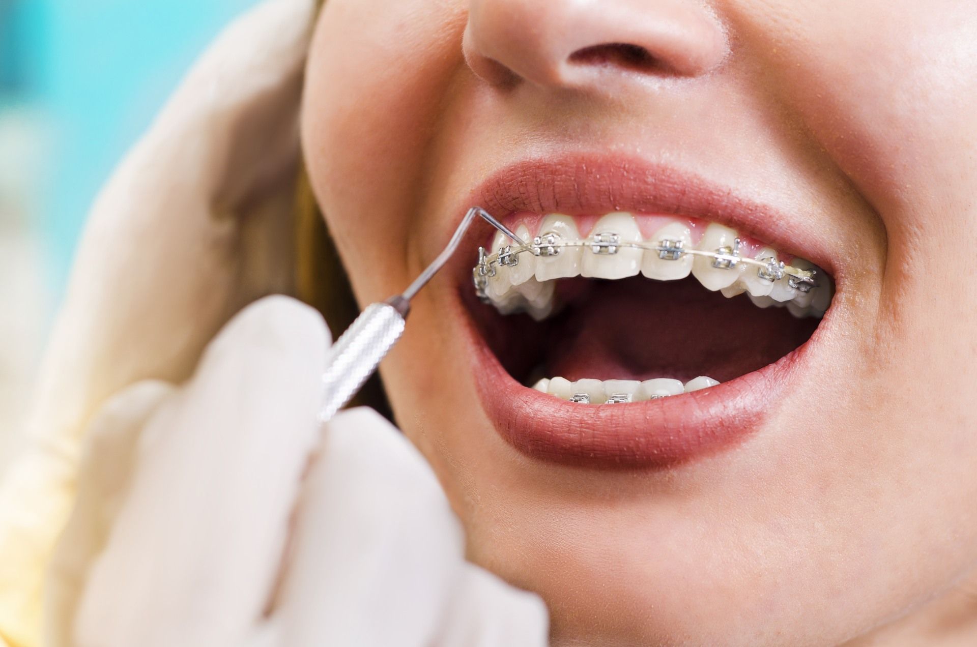 A woman with braces is getting her teeth examined by a dentist.