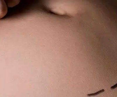 DR. JOAQUÍN CAMACHO LARA - CIRUGÍA PLÁSTICA DR. JOAQUÍN CAMACHO LARA - CIRUGÍA PLÁSTICA