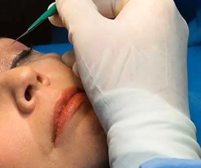 DR. JOAQUÍN CAMACHO LARA - REJUVENECIMIENTO FACIAL DR. JOAQUÍN CAMACHO LARA - REJUVENECIMIENTO FACIAL