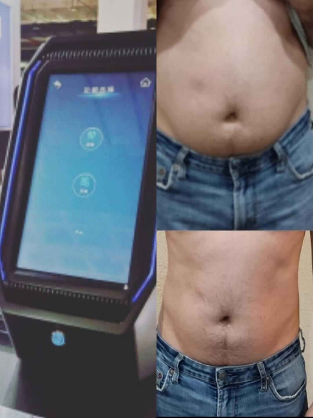 Estimulador muscular Estimulador muscular