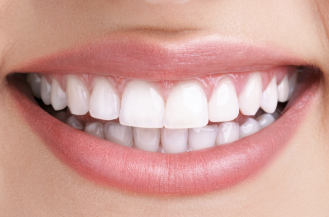 A close up of a woman 's smile with white teeth and pink lips.