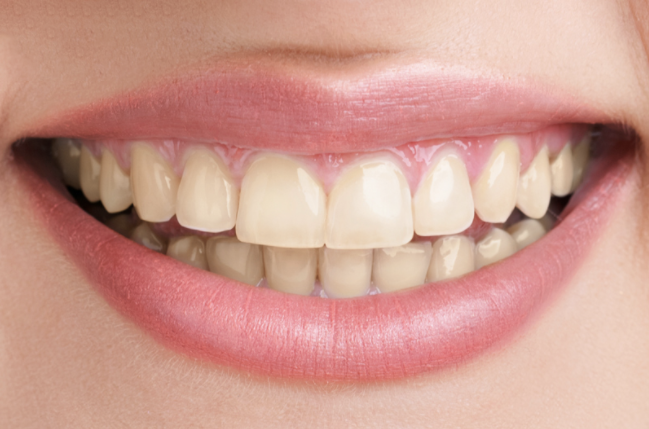 A close up of a woman 's smile with white teeth and pink lips.