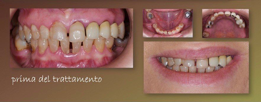 odontoiatria estetica prima