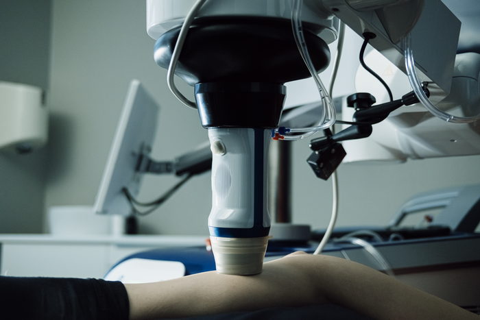 Traitement HIFU des varices
