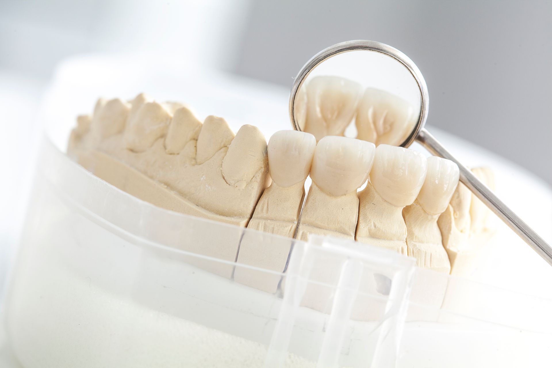 High-quality dental model with dentures and a dental mirror, showcasing reliable denture services.