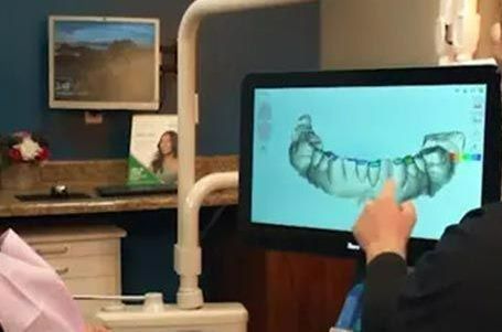 Dentist pointing at a 3D scan of teeth on a computer screen in a dental office.