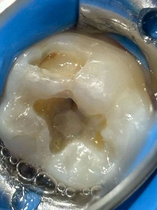 FOREVER DENTIST