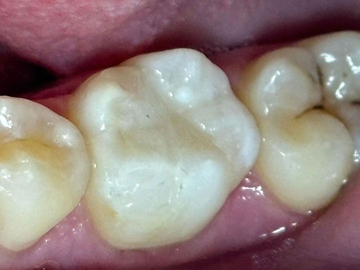 FOREVER DENTIST