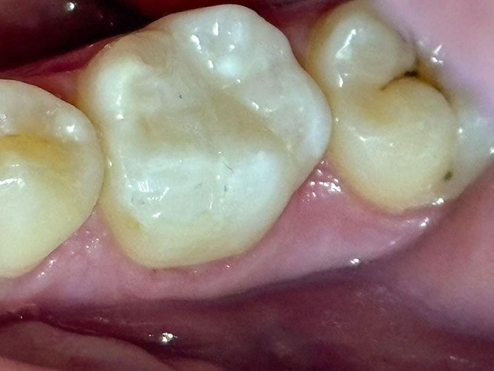 FOREVER DENTIST