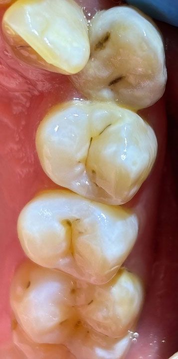 FOREVER DENTIST