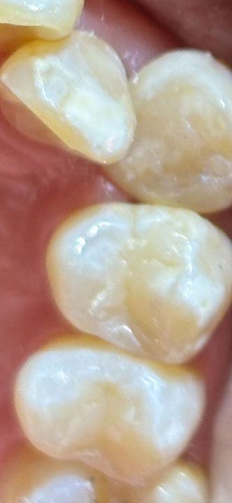 FOREVER DENTIST