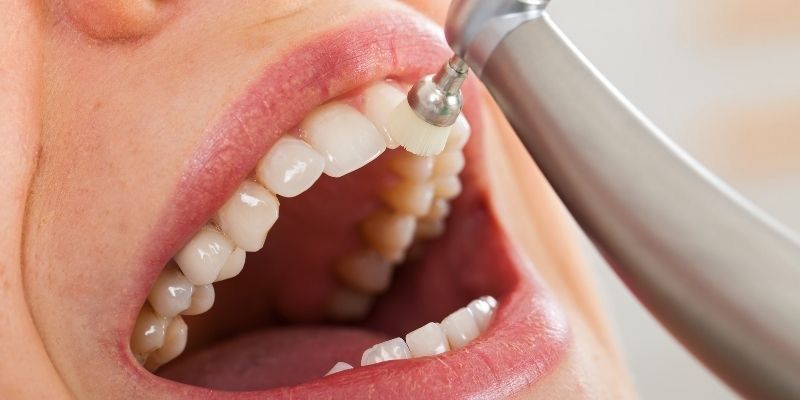 paciente a realizar uma limpeza dentária