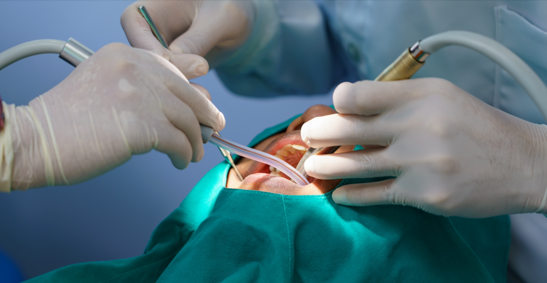 Oral surgery procedure