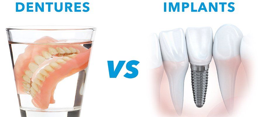 Dentures vs. Dental Implants in California