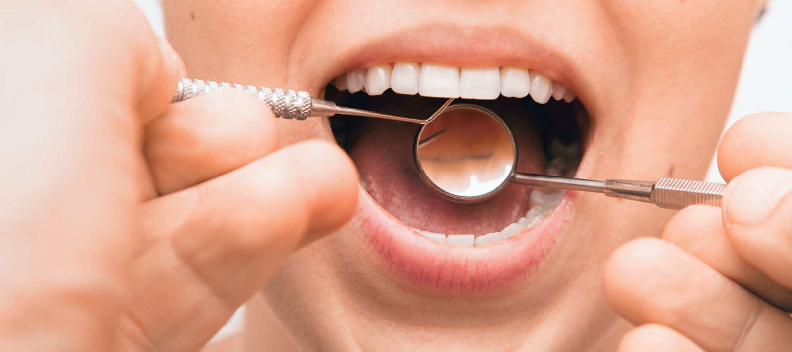 Oral Health and How It Affects Your Overall Health