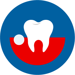 Abscess Tooth