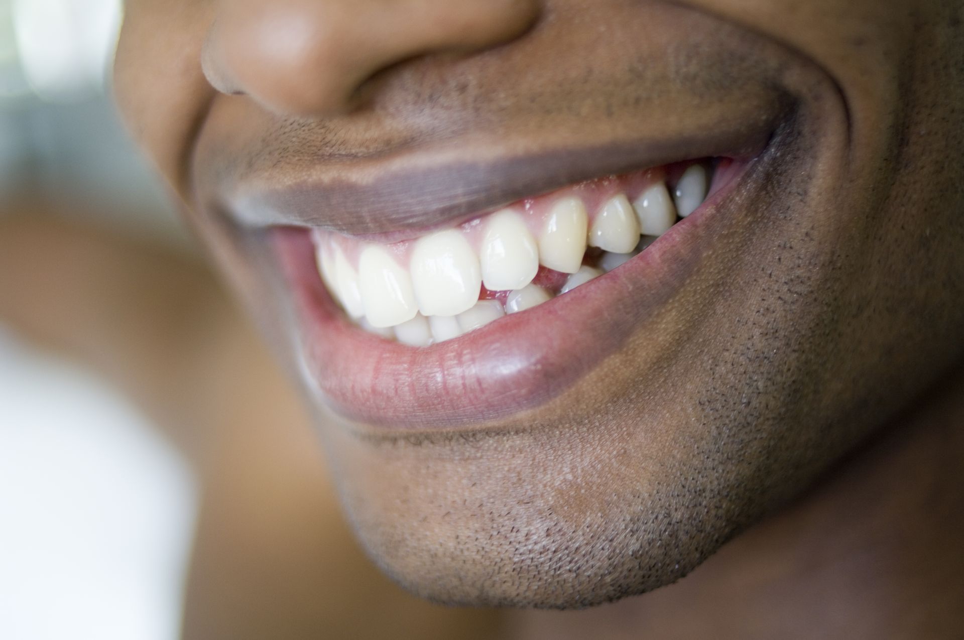 Close-up of a smiling mouth, showing white teeth, one missing tooth, and a dark complexion.