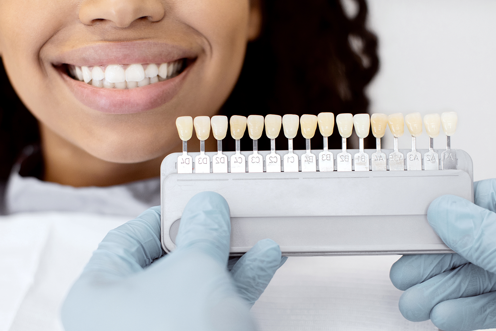 Dentist holding teeth shade guide next to smiling patient's teeth.