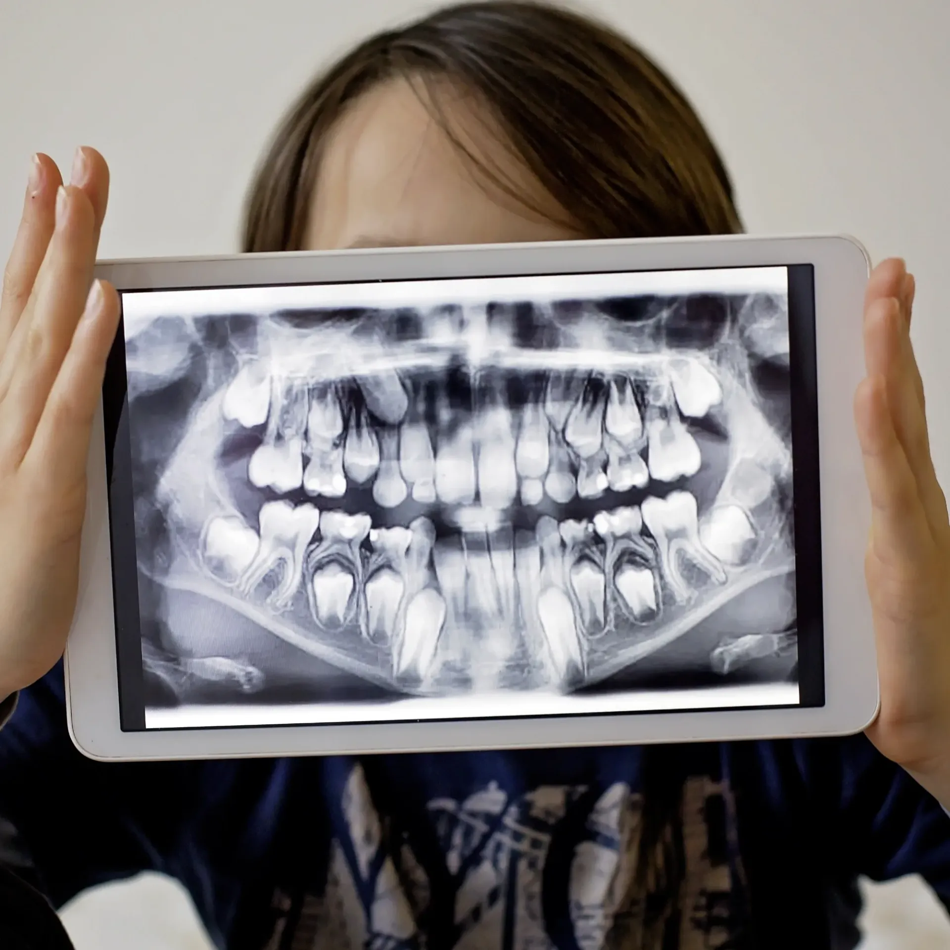 A girl is holding a tablet with an x-ray of her teeth on it