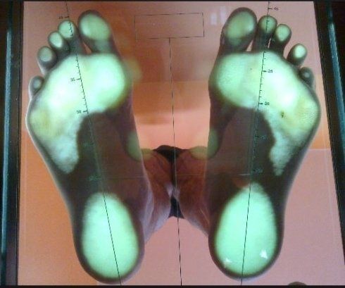 esame per verificare l'appoggio plantare