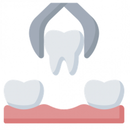 Tooth extraction: dental tool gripping a tooth above gums and two remaining teeth.