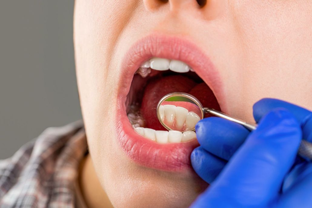 Dentist examining a patient’s open mouth with a dental mirror and blue gloves