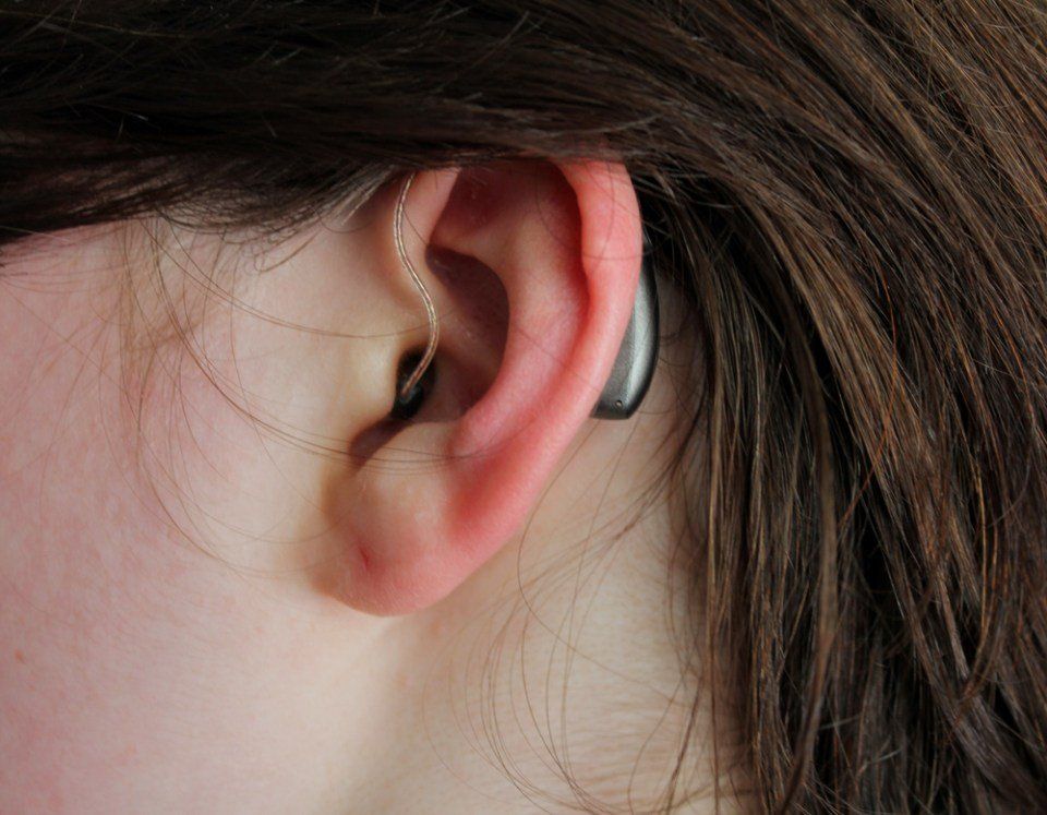 Discreto apparecchio uditivo retroauricolare