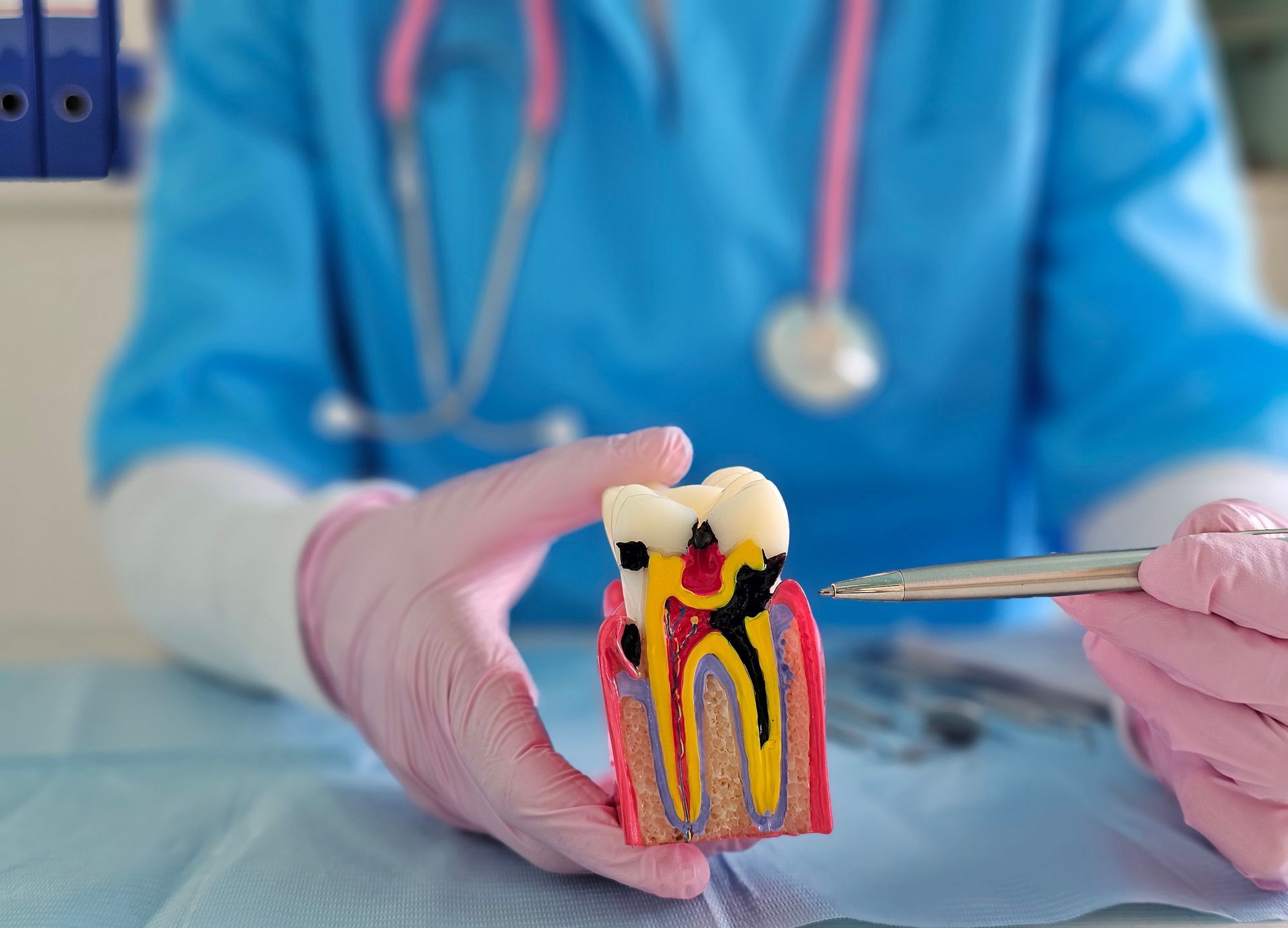 Dentist in gloves holding a cross-section tooth model showing decay and root canals Dentist in gloves holding a cross-section tooth model showing decay and root canals