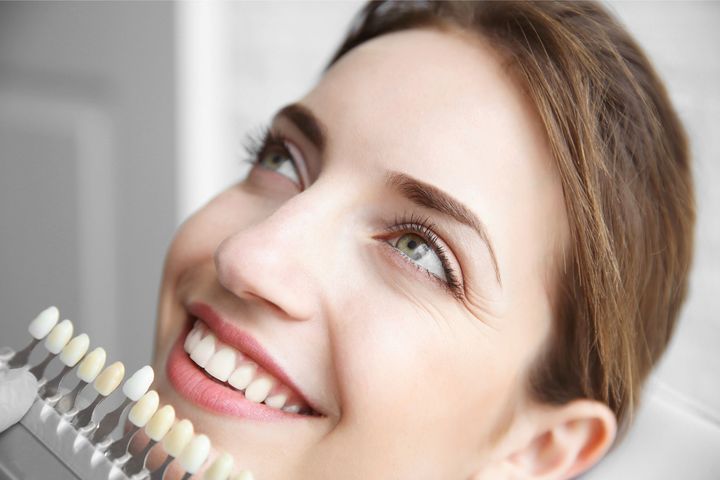 Impianti dentali