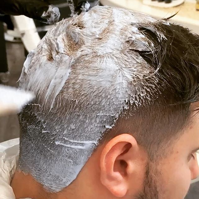 trattamento tricologico per uomo