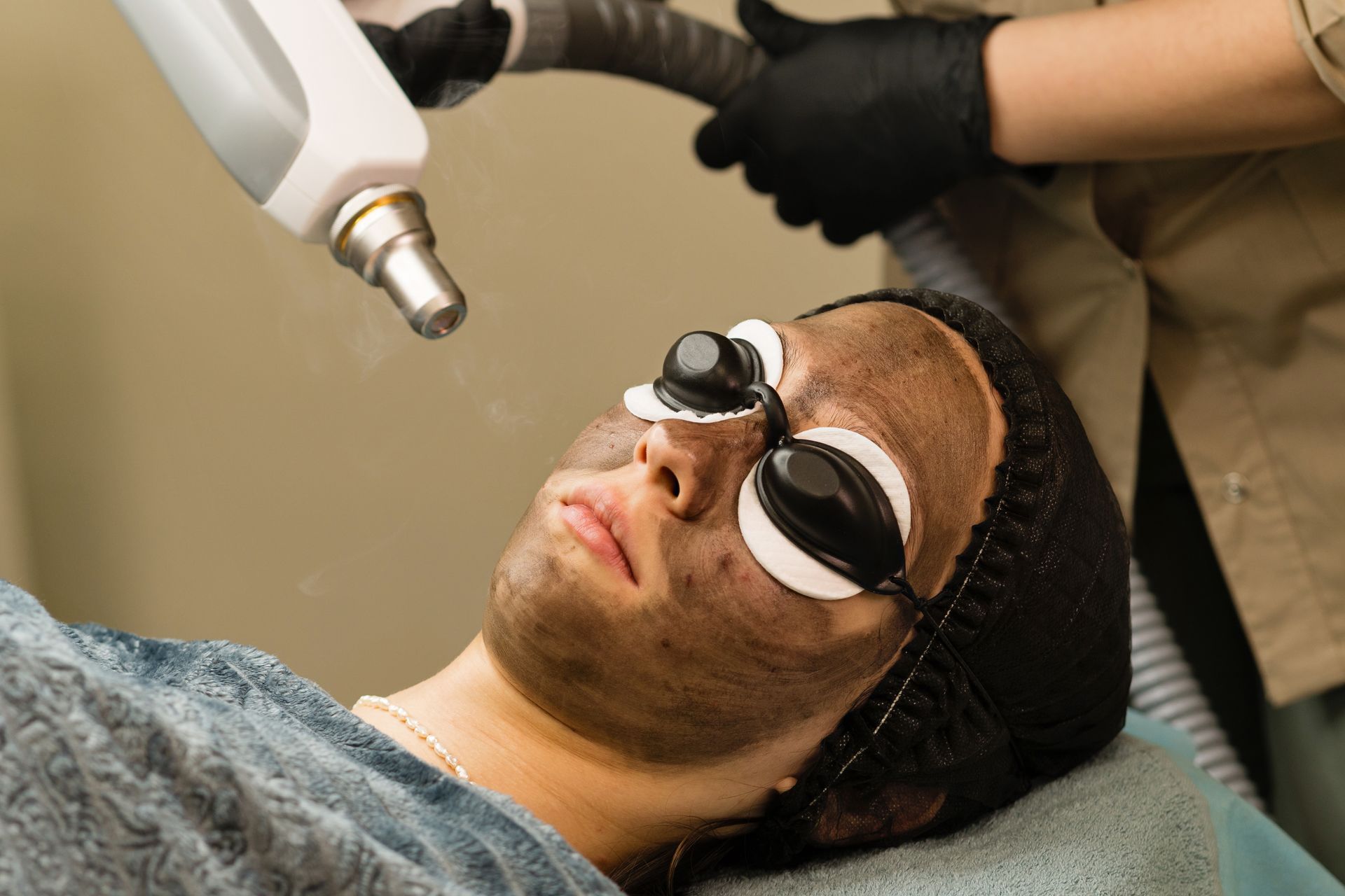 Person receiving carbon facial laser treatment at a clinic, wearing eye protection.