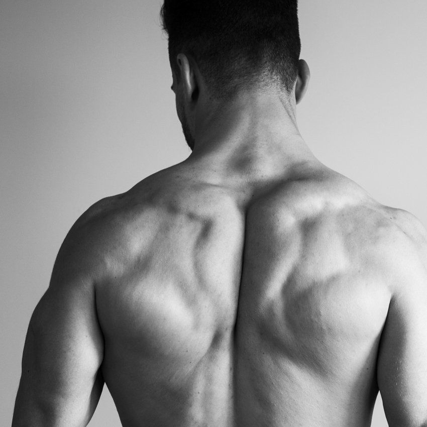 epilazione laser progressiva definitiva