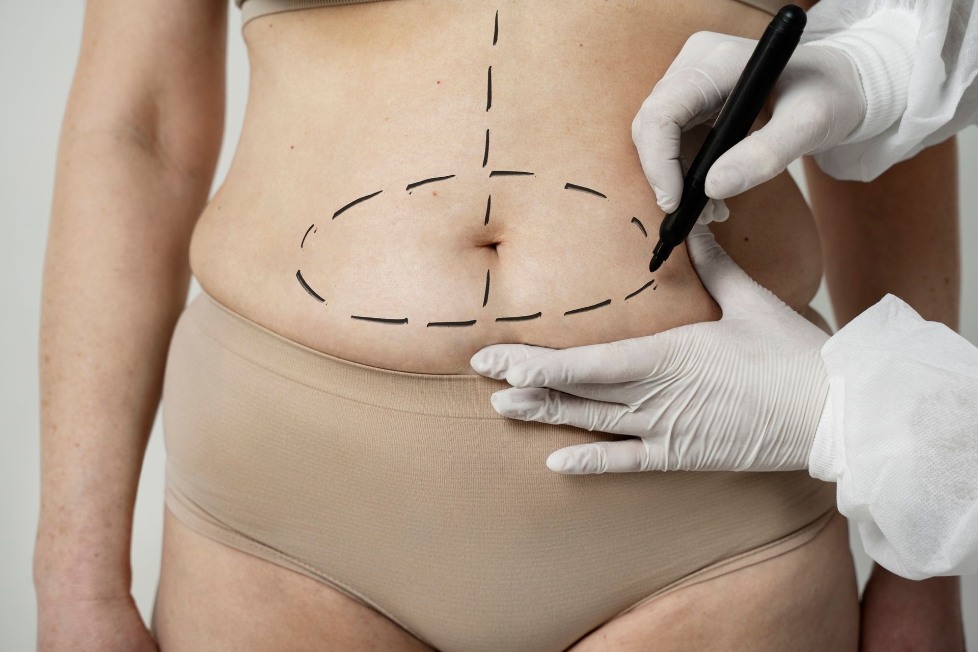 A person is drawing lines on a woman 's stomach with a marker.