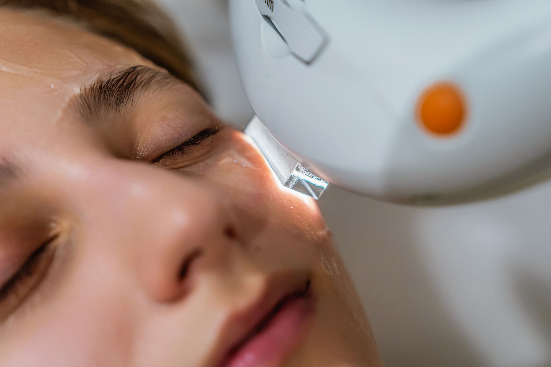 A woman is getting a laser treatment on her face.