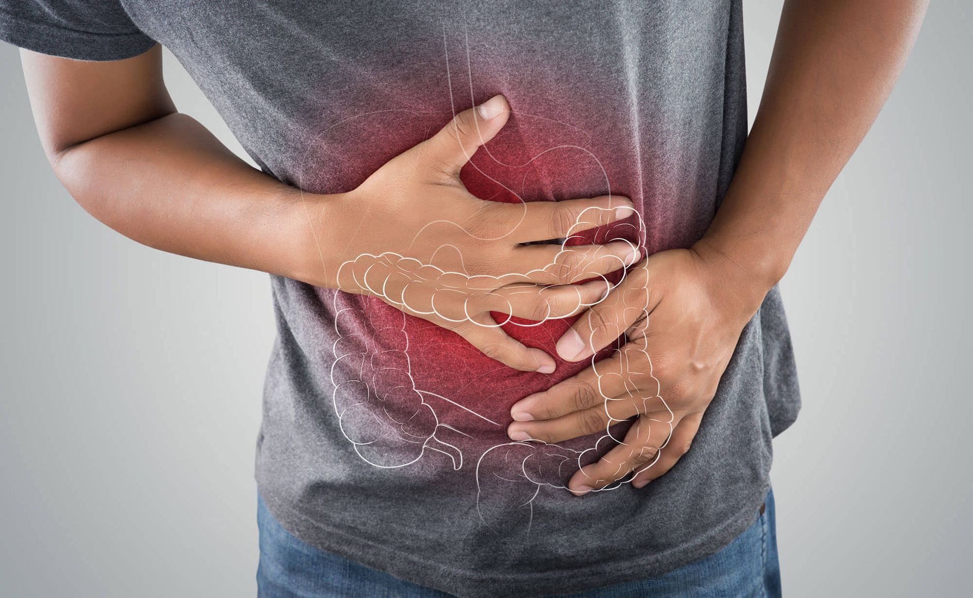 Colitis