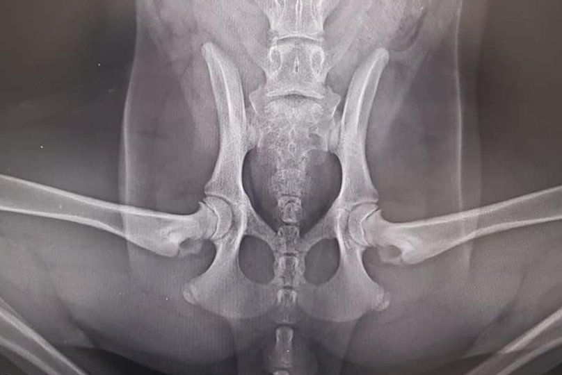 Radiografia Displasia