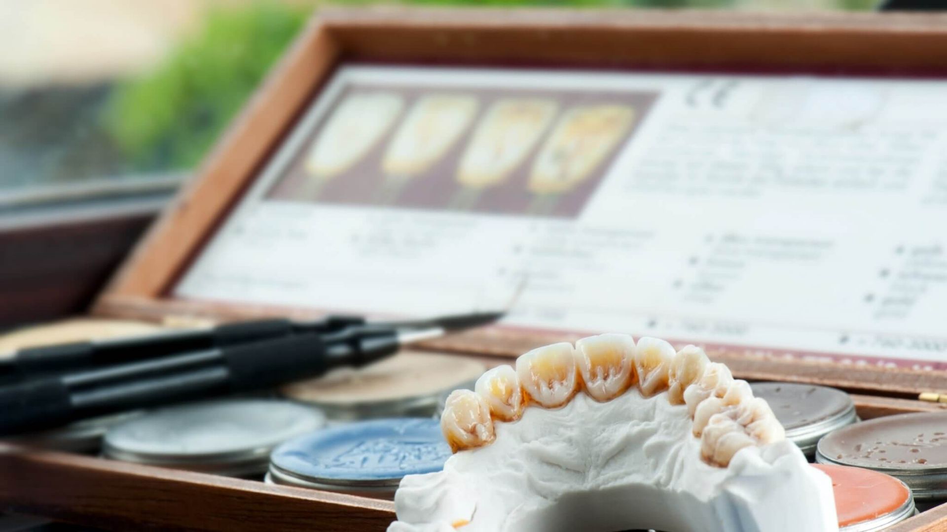 Different Types of Dental Crowns - Choosing the Best Fit