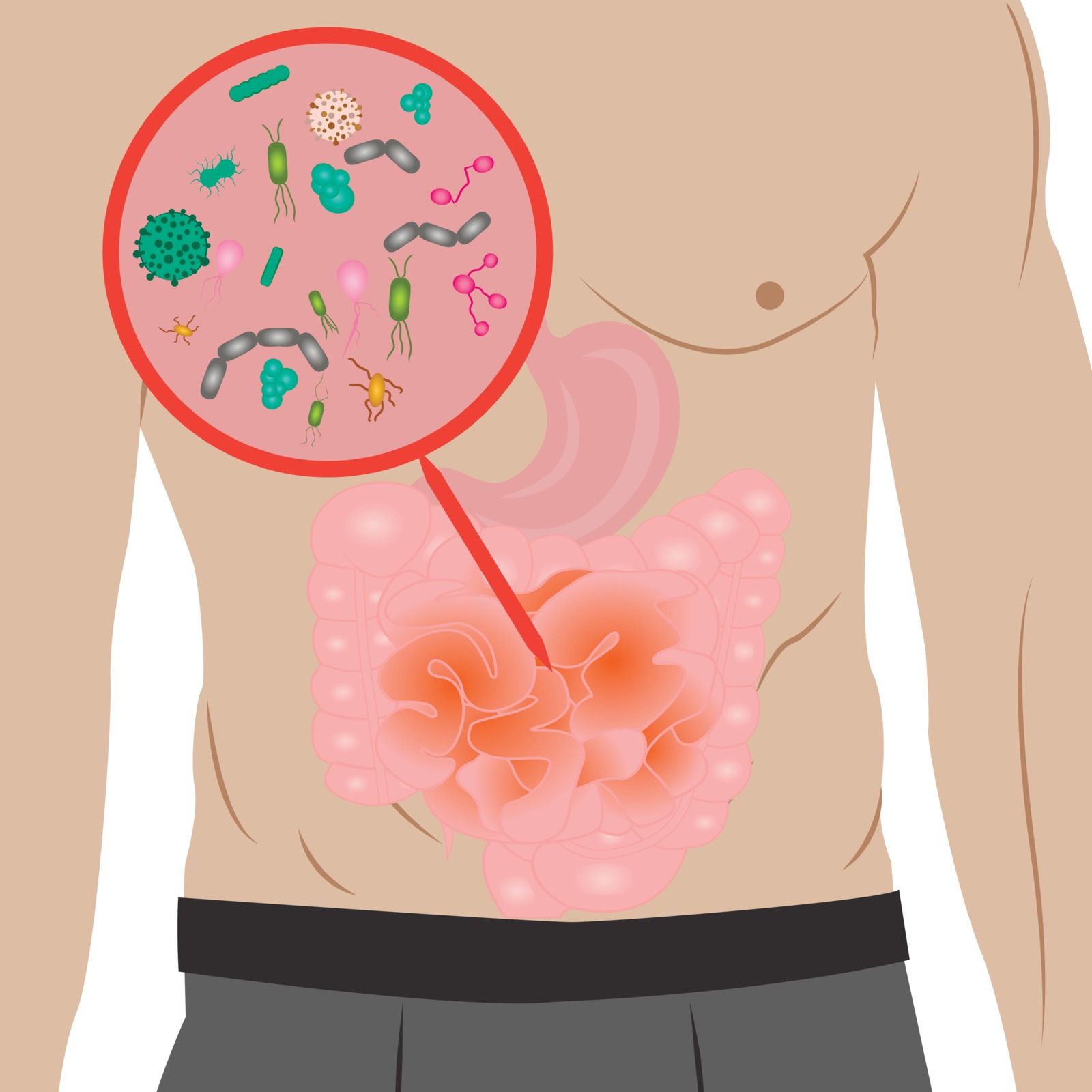 An illustration of a man 's stomach with a circle of bacteria in it